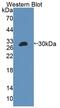 ATP Binding Cassette Subfamily F Member 2 antibody, LS-C663370, Lifespan Biosciences, Western Blot image 