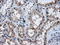 AKT Serine/Threonine Kinase 2 antibody, GTX84908, GeneTex, Immunohistochemistry paraffin image 