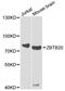 Zinc Finger And BTB Domain Containing 20 antibody, A7970, ABclonal Technology, Western Blot image 