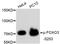 Forkhead Box O3 antibody, abx125445, Abbexa, Western Blot image 
