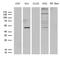 Glycerol-3-phosphate acyltransferase 3 antibody, LS-C792218, Lifespan Biosciences, Western Blot image 