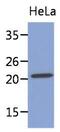 Myosin Light Chain 4 antibody, GTX53747, GeneTex, Western Blot image 