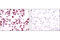 Androgen Receptor antibody, 5153T, Cell Signaling Technology, Immunohistochemistry paraffin image 