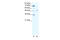 Interferon Regulatory Factor 5 antibody, 28-795, ProSci, Western Blot image 