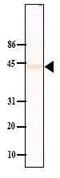 Protein Phosphatase, Mg2+/Mn2+ Dependent 1A antibody, GTX14824, GeneTex, Western Blot image 