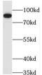 Pyridoxal Dependent Decarboxylase Domain Containing 1 antibody, FNab06293, FineTest, Western Blot image 