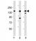 AXL Receptor Tyrosine Kinase antibody, F53357-0.4ML, NSJ Bioreagents, Western Blot image 