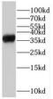 RPA Interacting Protein antibody, FNab07394, FineTest, Western Blot image 