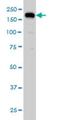 Ubiquitin Specific Peptidase 47 antibody, H00055031-M01, Novus Biologicals, Western Blot image 