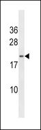 Heart And Neural Crest Derivatives Expressed 2 antibody, 62-132, ProSci, Western Blot image 