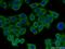 CLH-22 antibody, 66274-1-Ig, Proteintech Group, Immunofluorescence image 