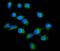 Protein Kinase C Delta antibody, RP1058, Boster Biological Technology, Immunofluorescence image 