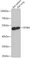 Splicing Factor 3b Subunit 4 antibody, 18-001, ProSci, Western Blot image 