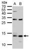 S100 Calcium Binding Protein A9 antibody, GTX129575, GeneTex, Western Blot image 