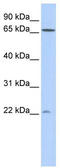 DIRAS Family GTPase 1 antibody, TA340389, Origene, Western Blot image 