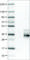 Tetraspanin 7 antibody, AMAb90621, Atlas Antibodies, Western Blot image 