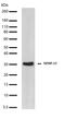 Matrix Metallopeptidase 13 antibody, 710311, Invitrogen Antibodies, Western Blot image 