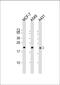 RAB13, Member RAS Oncogene Family antibody, M04339, Boster Biological Technology, Western Blot image 