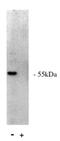 Protein Phosphatase 2 Regulatory Subunit B'Alpha antibody, orb108625, Biorbyt, Western Blot image 