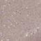Calcium Voltage-Gated Channel Auxiliary Subunit Gamma 4 antibody, NBP2-55176, Novus Biologicals, Immunohistochemistry frozen image 