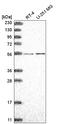 Coenzyme Q8B antibody, HPA028303, Atlas Antibodies, Western Blot image 
