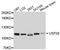 Ubiquitin carboxyl-terminal hydrolase 28 antibody, STJ112436, St John