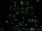Mediator Complex Subunit 21 antibody, H00009412-M04, Novus Biologicals, Immunocytochemistry image 