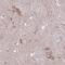 Potassium Voltage-Gated Channel Subfamily A Member Regulatory Beta Subunit 1 antibody, NBP1-90194, Novus Biologicals, Immunohistochemistry frozen image 