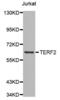 Telomeric Repeat Binding Factor 2 antibody, abx000567, Abbexa, Western Blot image 