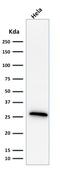 Heat Shock Protein Family B (Small) Member 1 antibody, GTX34784, GeneTex, Western Blot image 
