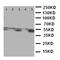 Aldehyde Dehydrogenase 3 Family Member A1 antibody, LS-C313508, Lifespan Biosciences, Western Blot image 