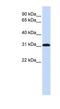 Replication Protein A4 antibody, NBP1-58156, Novus Biologicals, Western Blot image 