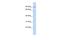 TCDD Inducible Poly(ADP-Ribose) Polymerase antibody, A09438, Boster Biological Technology, Western Blot image 