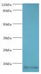 Calmodulin Like 5 antibody, MBS1492781, MyBioSource, Western Blot image 