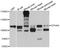 EPH Receptor A8 antibody, STJ112251, St John