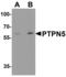Protein Tyrosine Phosphatase Non-Receptor Type 5 antibody, MBS153395, MyBioSource, Western Blot image 