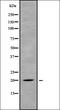 Major Histocompatibility Complex, Class II, DM Beta antibody, orb338369, Biorbyt, Western Blot image 