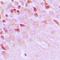 TRAF3 Interacting Protein 1 antibody, orb224089, Biorbyt, Immunohistochemistry paraffin image 