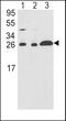 Rho GDP Dissociation Inhibitor Alpha antibody, MBS9210614, MyBioSource, Western Blot image 