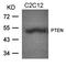 Myosin regulatory light chain 2A, cardiac muscle isoform antibody, orb14555, Biorbyt, Western Blot image 