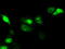 Serine Racemase antibody, M02660, Boster Biological Technology, Immunofluorescence image 