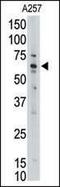 MLLT1 Super Elongation Complex Subunit antibody, PA5-13171, Invitrogen Antibodies, Western Blot image 