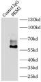 Pyruvate Kinase M1/2 antibody, FNab06495, FineTest, Immunoprecipitation image 