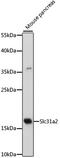 Solute Carrier Family 31 Member 2 antibody, 16-570, ProSci, Western Blot image 