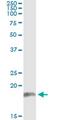 Protein Phosphatase 2 Regulatory Subunit B''Beta antibody, MA5-24568, Invitrogen Antibodies, Immunoprecipitation image 