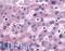 Dipeptidyl Peptidase 9 antibody, LS-A8308, Lifespan Biosciences, Immunohistochemistry frozen image 