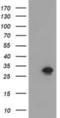 Nicotinamide Nucleotide Adenylyltransferase 1 antibody, NBP2-03452, Novus Biologicals, Western Blot image 