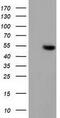 Glutathione Synthetase antibody, GTX84407, GeneTex, Western Blot image 