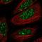 Thyroid Hormone Receptor Beta antibody, HPA061035, Atlas Antibodies, Immunofluorescence image 