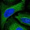 Adenosine Deaminase Like antibody, NBP2-55056, Novus Biologicals, Immunofluorescence image 